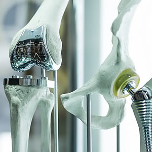The medical sector benefits from using alloys in areas such as implants and instruments.